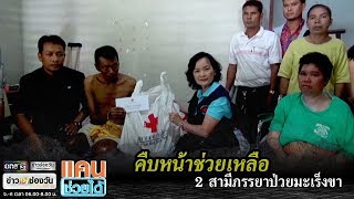 คืบหน้าช่วยเหลือ 2 สามีภรรยาป่วยมะเร็งขา | แคนช่วยได้ | ข่าวช่องวัน | one31