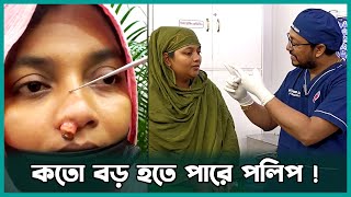 নাকের পলিপাস বাস্তবে দেখতে কেমন এবং এর চিকিৎসা কি | Dr. Bashudeb Kumar Saha