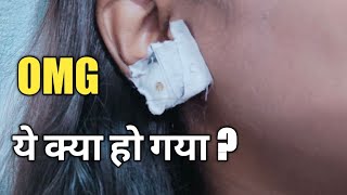 ear hole repair / ear lobes salutations / कान के छेद का बड़ा होने का इलाज #DeepRatan