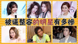 The star who was forced to undergo plastic surgery! Who is the worst