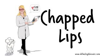 Chapped Lips? Healing Tips from Dermatologist - Dr. Bailey Skin Care (2017)