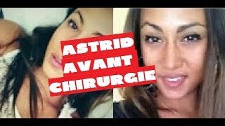 ASTRID NELSIA [ LES ANGES ] - AVANT CHIRURGIE