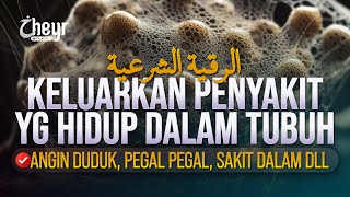 AYAT RUQYAH KELUARKAN SEGALA PENYAKIT DALAM TUBUH - الرقية الشرعية