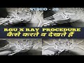 RGU X Ray Procedure In Hindi || RGU X Ray || RGU X Ray Ko Kese Dekhte Hai