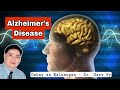 Alzheimer's Disease - Dr. Gary Sy