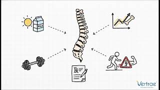Compression Fractures Explained — Why Bones Collapse & How They Heal | Dr. Kamal Woods | Vertrae®