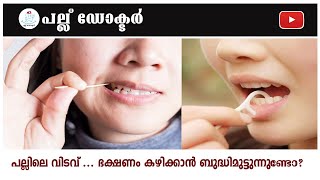 പല്ലിലെ വിടവ് ... ഭക്ഷണം കഴിക്കാൻ ബുദ്ധിമുട്ടുന്നുണ്ടോ ?