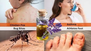 This Happens When You Use LAVENDER Oil Everyday 😮 10 Essential Oil Remedies