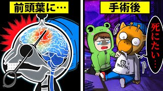 ロボトミー手術をするとどうなるのか？【怖い話】【アニメ】【都市伝説】