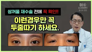 쌍꺼풀 재수술 이런경우만 꼭 두줄따기 하세요. (비아이오성형외과 홍성표)