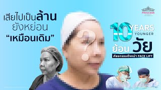 รีวิว| 'กรุง ศรีวิไล'อึ้งหนักมากภรรยาสวยจำไม่ได้ ยอมรับหวงขั้นสุด ไม่อยากเชื่อนี่วัย63 #ดึงหน้า