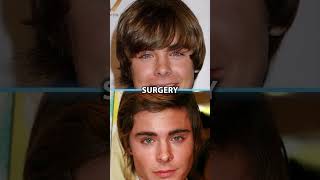 Did Zac Efron Have Plastic Surgery?