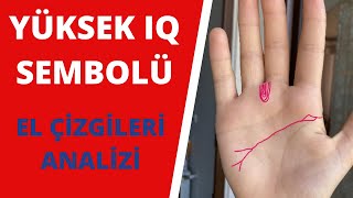 Yüksek IQ Sembolü - El Çizgileri Analizi - Akıl Çizgisindeki Siyah Benin Anlamı -Dönük Parmak Uçları