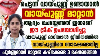 വായ്പ്പുണ്ണ് വരാൻ കാരണം |വായ്പ്പുണ്ണ് പൂർണമായി മാറ്റാൻ കഴിക്കേണ്ട 3 ഭക്ഷണങ്ങൾ