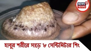 মানুষের শরীরে শিং, দেশে প্রথম বলেও দাবি