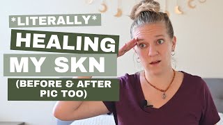 Tallow Skin Care | Tallow Benefits on Skin | Tallow Skin Care Before & After