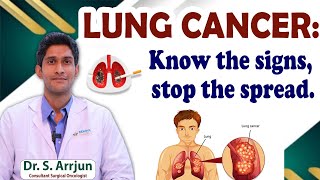 Warning Signs of Lung Cancer || Lung Cancer Symptoms Treatment || Dr Arrjun || Renova Hospitals