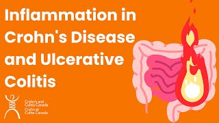 Inflammation in Crohn's Disease and Ulcerative Colitis