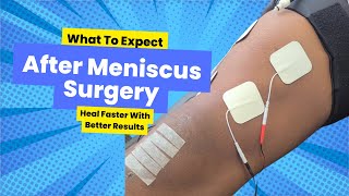 What To Expect After Meniscus Repair Surgery