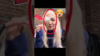 Who punched Rosè 's face? 😡😭 #rosé #fypシ゚viral #ytshorts #blink #blackpink @roses_are_rosie