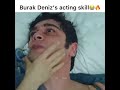 Burak Deniz's Acting Skill😊🔥 | Whatsapp Short Video | Dream Status |