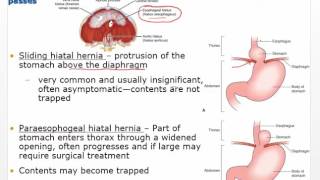 Chapter29 Video   Disorders of GI function