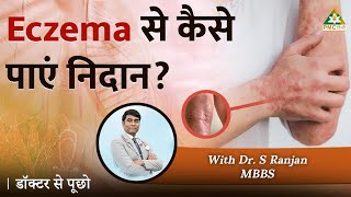 How To Get Rid Of Eczema naturally?  | Doctor Se Pucho with Dr. S Ranjan