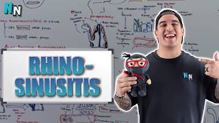 Rhinosinusitis | Clinical Medicine