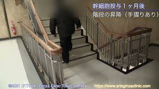 Case-22：変形性膝関節症 発症1年半 60代男性