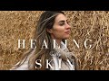 HEALING MY SKIN & ELEGANT OUTFIT SHOPPING | Lydia Millen