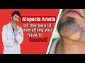 Alopecia Areata of the Beard everything you have to know