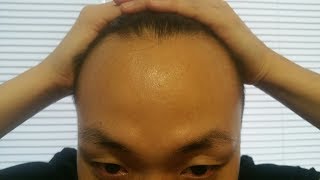 HOW TO FIND OUT HOW BALD YOU ARE!