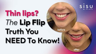 Everything You Need To Know About A Lip Flip