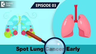 EARLY WARNING SIGNS of Lung Cancer | Spot Lung Cancer Early | Lung Cancer Screening- Doctors' Circle