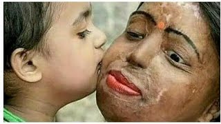 Story of a blind mother | Odia Motivational Video | ଜଣେ ଅନ୍ଧୁଣି ମା ର କାହାଣୀ ।