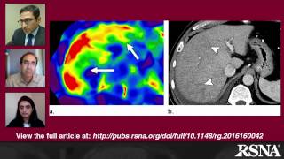 Elastography in Chronic Liver Disease: Modalities, Techniques, Limitations, and Future Directions