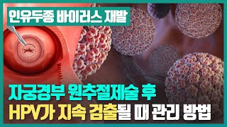 원추절제술 후 HPV가 지속 검출될 때 관리 방법