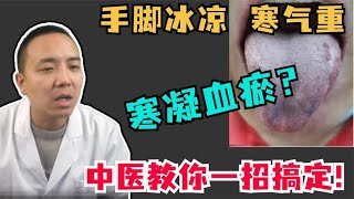 手脚冰凉寒气重，寒凝血瘀？中医教你一招搞定！