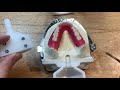 dent 3027 project 1 ivobase investing mandibular