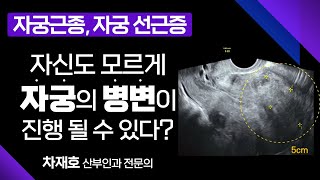 여성 건강의 적신호 '자궁근종' , '자궁선근증' / 나날이 증가하고 있는 여성질환 /  메디컬다큐365 부산MBC 20210412 방송