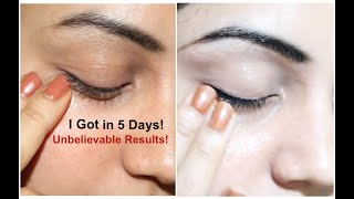 I Found a Successful ’Cure' for MY DARK CIRCLES, FINE LINES, WRINKLES & PUFFINESS |RESULTS IN 5 DAYS