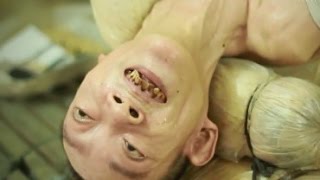 閲覧注意 47年間吊るされ続ける男と家族の苦悩の話 奇病 難病 閲覧注意 47年間吊るされ続ける男と家族の苦悩の話 奇病 難病