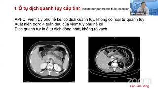 HÌNH ẢNH HỌC CỦA VIÊM TỤY CẤP DO TĂNG TRIGLYCERID | TS. BS. Hoàng Văn Quang