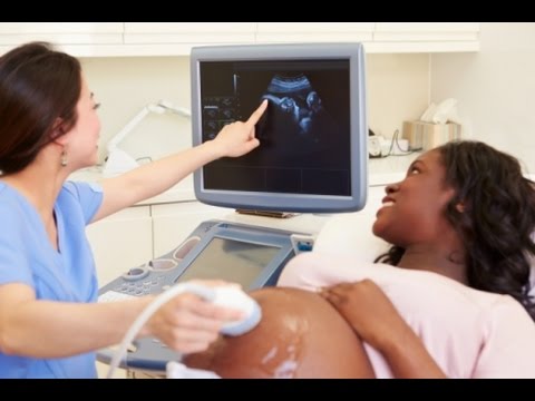 YOUR HEALTH: Fibroids and pregnancy YOUR HEALTH: Fibroids and pregnancy