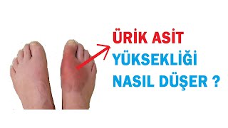 ÜRİK ASİT YÜKSEKLİĞİ NASIL DÜŞÜRÜLÜR ?