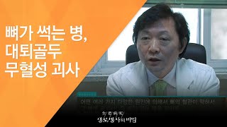 뼈가 썩는 병, 대퇴골두 무혈성 괴사 - (2011.3.19_365회 방송)_술배