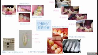 26 醫藥人  楊幽幽 牙髓死亡及測試  Editor-in-chief Online Journal of Dentistry \u0026 Oral Health