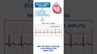 Diagnostics on Demand: Cardiac tamponade