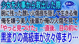 【感動】子供の時に火事現場から少女を救出。その時腕に残った醜い火傷の痕を隠して生きる俺。ある日、俺を嫌う美人後輩「その腕の火傷って…！？」→直後、目の前に黒塗りの高級車が次々停まり…【泣ける・良