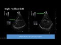 critical care U/S, New ideas.